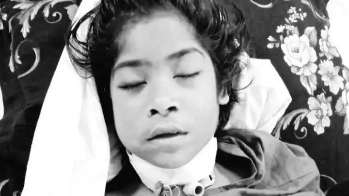 চট্টগ্রামে জঙ্গলে গলা কাটা অবস্থায় হাঁটতে থাকা সেই শিশু জান্নাতুল নিশা ইরা মারা গেছে