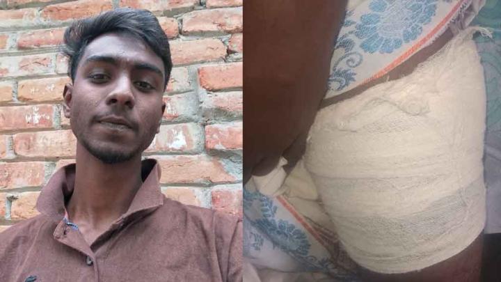 বগুড়ায় তুচ্ছ ঘটনাকে কেন্দ্র করে কিশোরকে ছুরিকাঘাত