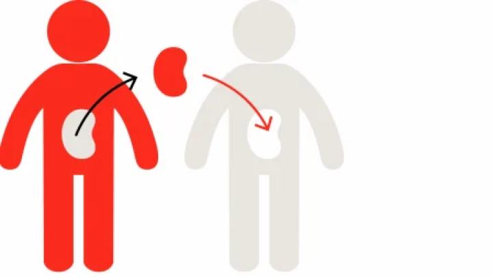 কিডনি প্রতিস্থাপন: নতুন আইনেও বাড়ছে না ‘ইমোশনাল ডোনার’